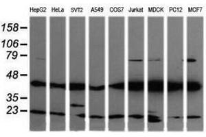 Image no. 7 for anti-Mitogen-Activated Protein Kinase Kinase 1 (MAP2K1) antibody (ABIN1499381)