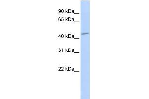 WB Suggested Anti-SGMS1 Antibody Titration: 0. (Sphingomyelin Synthase 1 anticorps  (Middle Region))