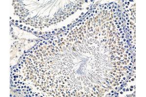 ABIN7096598 and ABIN7100662 at 1/100 staining rat testis tissue by IHC-P. (Fascin 2 anticorps)