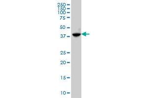 ABHD5 monoclonal antibody (M02), clone 4B12 Western Blot analysis of ABHD5 expression in A-431 . (ABHD5 anticorps  (AA 240-342))