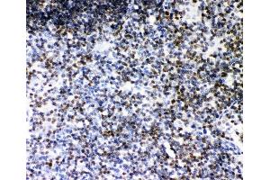 IHC analysis of RUNX1 using anti-RUNX1 antibody (ABIN3043318). (RUNX1 anticorps  (Middle Region))