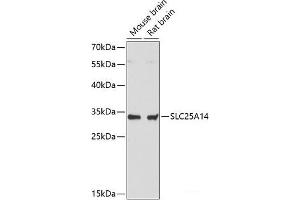 Western blot analysis of extracts of various cell lines using SLC25A14 Polyclonal Antibody at dilution of 1:3000. (SLC25A14 anticorps)