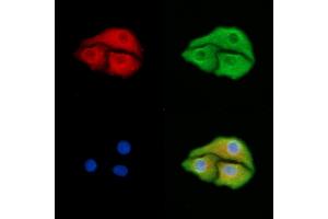 ABIN6259253 and ABIN6275428 staining Hela cells by IF/ICC. (PDXDC1 anticorps  (C-Term))