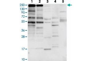 Western blot analysis of Lane 1: RT-4, Lane 2: U-251 MG, Lane 3: Human Plasma, Lane 4: Liver, Lane 5: Tonsil with ZNF646 polyclonal antibody  at 1:250-1:500 dilution. (ZNF646 anticorps)