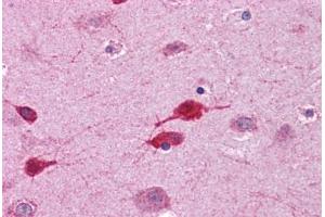 Human Brain, Cortex: Formalin-Fixed, Paraffin-Embedded (FFPE)