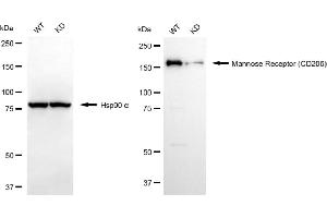 Western blotting analysis using mannose receptor (CD206) antibody (ABIN7799329). (Recombinant Mannose Receptor anticorps)