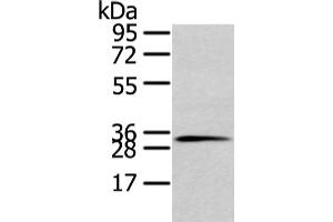 Gel: 10 % SDS-PAGE, Lysate: 80 μg, Lane: 231 cell, Primary antibody: ABIN7128026(STX19 Antibody) at dilution 1/800 dilution, Secondary antibody: Goat anti rabbit IgG at 1/8000 dilution, Exposure time: 10 seconds (Syntaxin 19 anticorps)