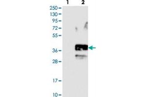 Western blot analysis of Lane 1: Negative control (vector only transfected HEK293T lysate). (SLC10A2 anticorps)