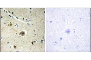 Immunohistochemistry analysis of paraffin-embedded human brain tissue, using Collagen IV alpha4 Antibody. (Col4a4 anticorps  (AA 541-590))