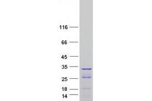 Validation with Western Blot