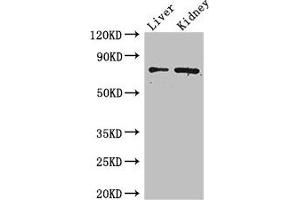 Western Blot Positive WB detected in: Mouse liver tissue, Mouse kidney tissue All lanes: ZFP64 antibody at 4 μg/mL Secondary Goat polyclonal to rabbit IgG at 1/50000 dilution Predicted band size: 75, 69, 73, 49, 47 kDa Observed band size: 75 kDa (ZFP64 anticorps  (AA 70-342))