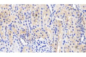Detection of IL18 in Porcine Kidney Tissue using Polyclonal Antibody to Interleukin 18 (IL18)