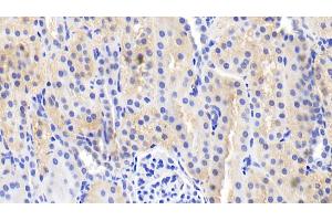 Detection of IL18 in Porcine Kidney Tissue using Polyclonal Antibody to Interleukin 18 (IL18) (IL-18 anticorps  (AA 36-192))