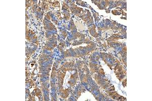 IHC analysis of SNPH using anti-SNPH antibody (ABIN7601724). (Syntaphilin anticorps  (AA 43-482))