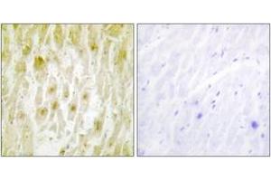 Immunohistochemistry analysis of paraffin-embedded human heart tissue, using TF2E2 Antibody. (GTF2E2 anticorps  (AA 151-200))