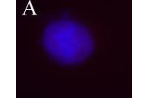 Image no. 3 for anti-Aurora Kinase B (AURKB) (pThr232) antibody (ABIN230502) (Aurora Kinase B anticorps  (pThr232))