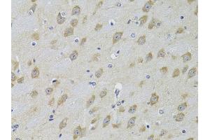 Immunohistochemistry of paraffin-embedded mouse brain using  Antibody (ABIN3022786, ABIN3022787, ABIN3022788 and ABIN6219229) at dilution of 1:100 (40x lens).