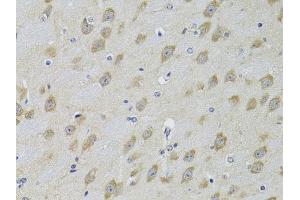 Immunohistochemistry of paraffin-embedded mouse brain using  Antibody (ABIN3022786, ABIN3022787, ABIN3022788 and ABIN6219229) at dilution of 1:100 (40x lens). (ADRBK2 anticorps  (AA 1-300))
