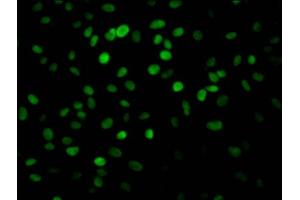 Immunofluorescence staining of Hela Cells with ABIN7127667 at 1:50, counter-stained with DAPI.