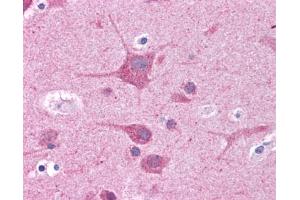 Immunohistochemistry (IHC) image for anti-RAR-Related Orphan Receptor C (RORC) (N-Term) antibody (ABIN2782284)