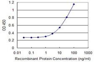 Detection limit for recombinant GST tagged SIK1 is 0.