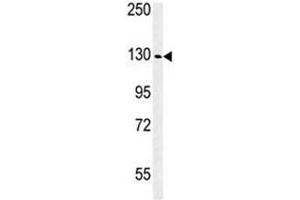 Western blot analysis of IGF1R antibody and WiDr lysate.