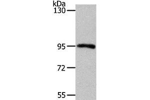 Western Blot analysis of Mouse kidney tissue using MYSM1 Polyclonal Antibody at dilution of 1:1100 (MYSM1 anticorps)