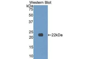 Detection of Recombinant COL17, Human using Polyclonal Antibody to Collagen Type XVII (COL17)