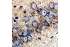 Immunohistochemistry (IHC) image for anti-Retinol Binding Protein 2, Cellular (RBP2) antibody (ABIN7308264)