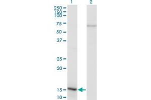Western Blot analysis of NFATC2IP expression in transfected 293T cell line by NFATC2IP monoclonal antibody (M02), clone 3E9-B7.
