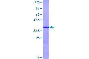 Image no. 1 for Eukaryotic Translation Elongation Factor 1 alpha 2 (EEF1A2) (AA 364-462) protein (GST tag) (ABIN1352347)