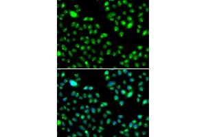 Immunofluorescence analysis of MCF7 cell using L3MBTL3 antibody. (L3MBTL3 anticorps)