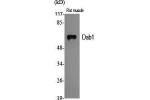 Western Blot (WB) analysis of specific cells using Dab1 Polyclonal Antibody. (DAB1 anticorps  (Ser296))