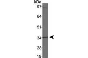 Western blot analysis of DLX4 in MDA-MB-231 cell lysates using DLX4 polyclonal antibody . (DLX4 anticorps  (AA 1-60))