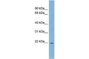 WB Suggested Anti-LBX2 Antibody Titration:  0. (LBX2 anticorps  (Middle Region))