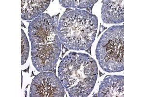 IHC testing of FFPE mouse testis tissue with GSTM3 antibody at 1ug/ml. (GSTM3 anticorps)
