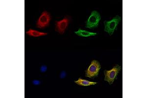 ABIN7094885 and ABIN7098938 staining Hela cells by IF/ICC. (LIF anticorps  (N-Term))