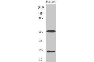 Western Blotting (WB) image for anti-Lecithin Retinol Acyltransferase (Phosphatidylcholine--Retinol O-Acyltransferase) (LRAT) (Internal Region) antibody (ABIN3185408) (LRAT anticorps  (Internal Region))