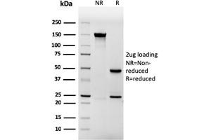 SDS-PAGE Analysis Purified Involucrin Mouse Recombinant Monoclonal Antibody (rIVRN/827). (Recombinant Involucrin anticorps)