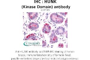 Image no. 1 for anti-Hormonally Up-Regulated Neu-Associated Kinase (HUNK) antibody (ABIN1735637) (HUNK anticorps)