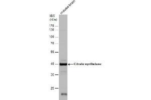WB Image Citrate synthetase antibody detects Citrate synthetase protein by western blot analysis.