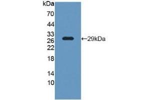 Detection of Recombinant LCP1, Human using Polyclonal Antibody to L-Plastin (LCP1) (LCP1 anticorps  (AA 5-233))