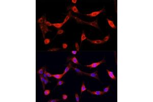 Immunofluorescence analysis of NIH/3T3 cells using EGFR antibody. (EGFR anticorps  (AA 1021-1210))