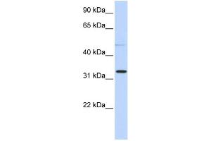 WB Suggested Anti-NEU4 Antibody Titration: 0. (Sialidase 4 anticorps  (N-Term))