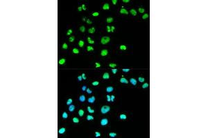 Immunofluorescence analysis of HeLa cell using MSH6 antibody. (MSH6 anticorps  (AA 1-290))
