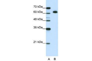 WB Suggested Anti-MGC42174 Antibody Titration:  1. (DIS3L2 anticorps  (N-Term))