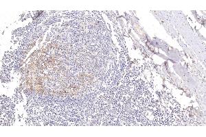 Detection of CD23 in Human Tonsil Tissue using Polyclonal Antibody to Cluster Of Differentiation 23 (CD23)