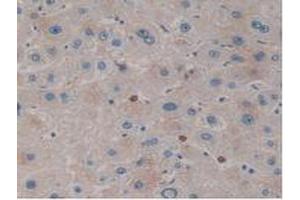 IHC-P analysis of Human Liver Tissue, with DAB staining. (Kallikrein 10 anticorps  (AA 35-276))
