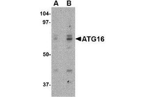Western blot analysis of ATG16 in HeLa cell lysate with this product atG16 antibody at (A) 0. (ATG16L1 anticorps  (Center))