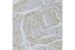 Immunohistochemistry of paraffin-embedded rat heart using GPD1 Antibody.